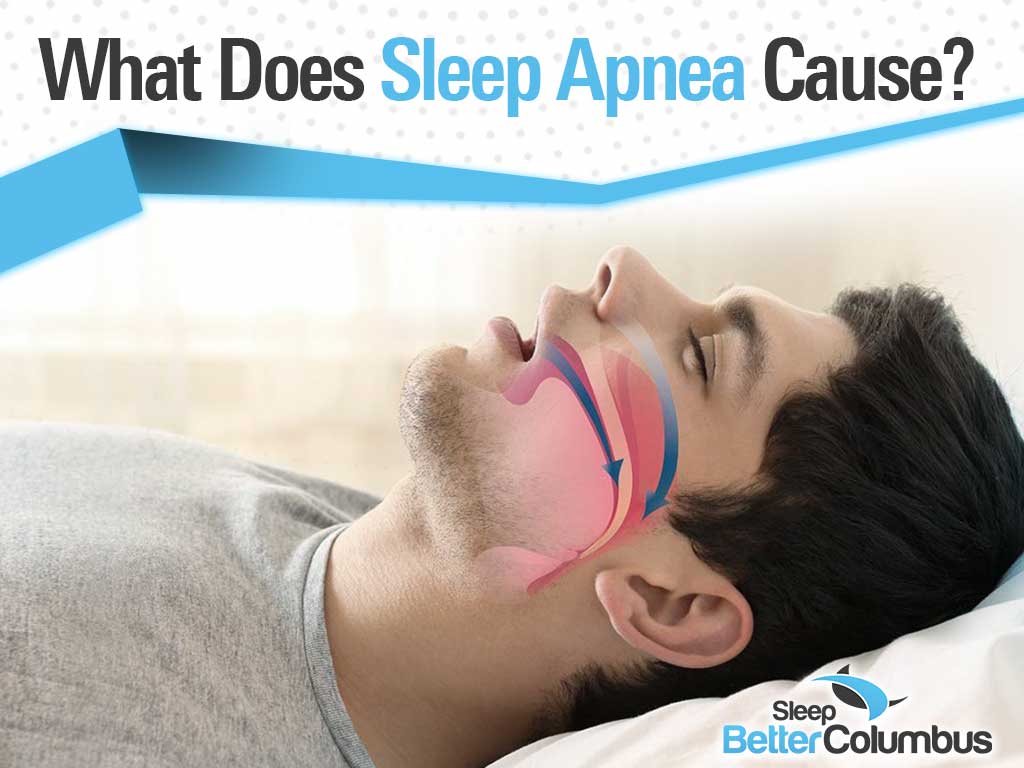 Photo of a man sleeping with his mouth open with the text: What Does Sleep Apnea Cause?