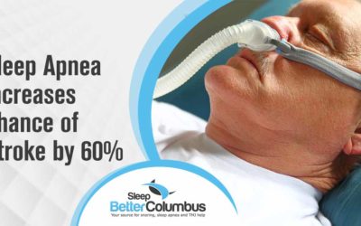 Sleep Apnea Increases Chance of Stroke by 60%