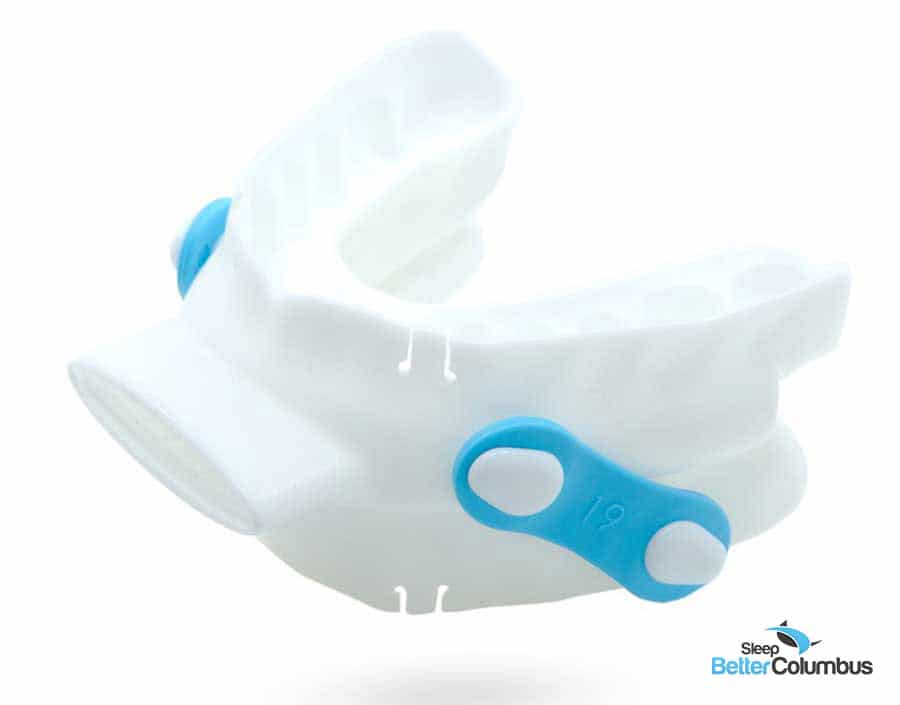 White plastic mouth guard for Obstructive Sleep Apnea by O2Vent Optima